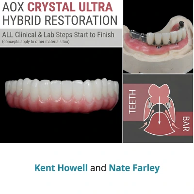 AOX Crystal Ultra Hybrid Restoration: All Clinical & Lab Steps Start to Finish