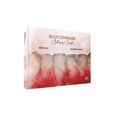 Root Coverage – Challenging Concepts