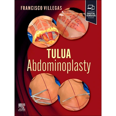 TULUA Abdominoplasty: Transverse Plication Technique