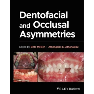 Dentofacial and Occlusal Asymmetries