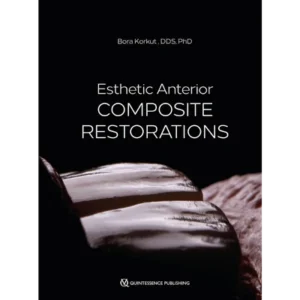 Esthetic Anterior Composite Restorations