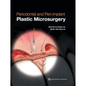 Periodontal and Peri-implant Plastic Microsurgery: Minimally Invasive Techniques with Maximum Precision