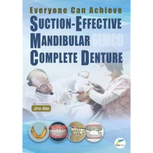 Everyone Can Achieve SUCTION-EFFECTIVE MANDIBULAR COMPLETE DENTURE