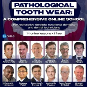 Mastering Pathological Tooth Wear: Clinical & Technical Protocols